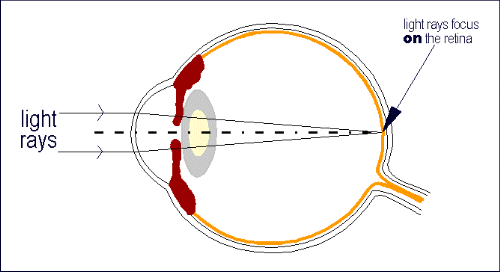 φυσιολογικός οφθαλμός (from:Cornea Genetic Eye Institute)